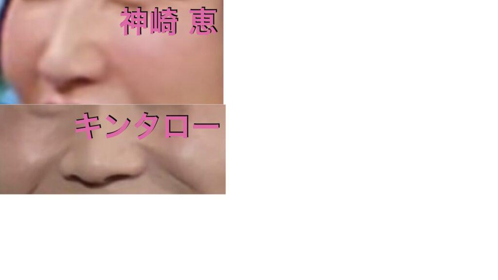 神崎恵とキンタローの鼻の比較